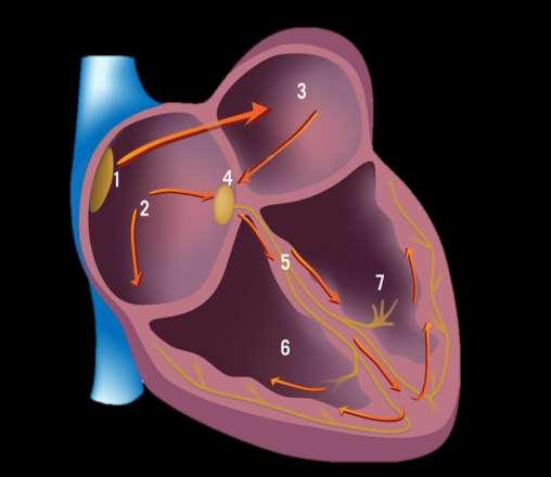 Indications: pediatric pacemakers Sinus node