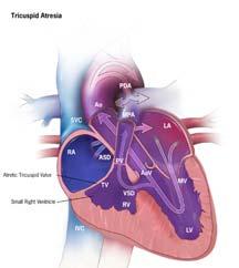 years Warnes J Am Coll Cardiol 2008 Special Situations Pregnancy, laparoscopy, regional & neuraxial Atrial