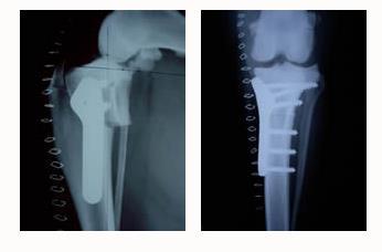 Stifle Injury Tibial Plateau Leveling Osteotomy Medially Luxating Patella Cause genetic predisposition, generally seen in small breed dogs