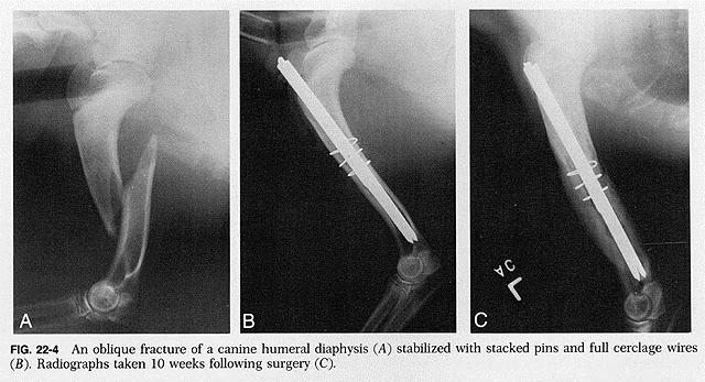 Humeral, Radial and Ulnar