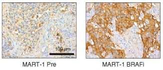 Targeted therapies: MAPKi in melanoma BRAF mut Dual MAPK pathway