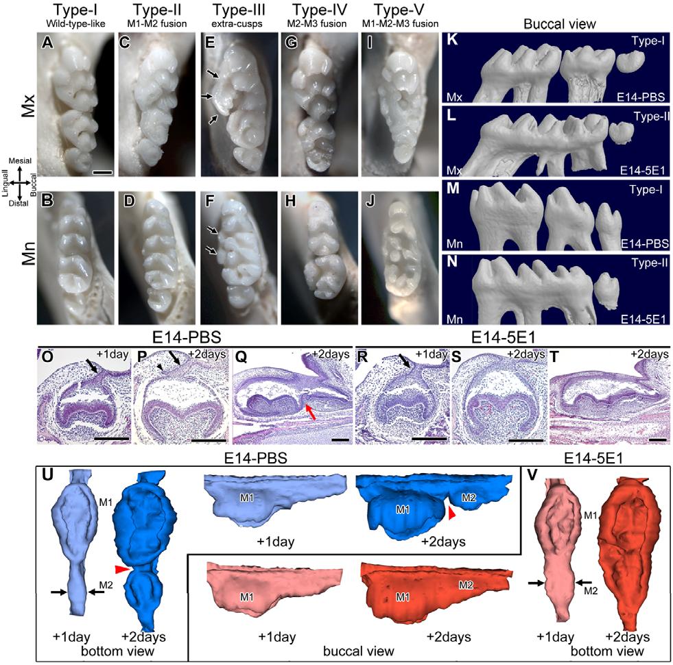 Wnts, Shh and Sostdc1 in tooth patterning RESEARCH ARTICLE 1809 where A, M and I are activator, mediator and inhibitor concentration, respectively.