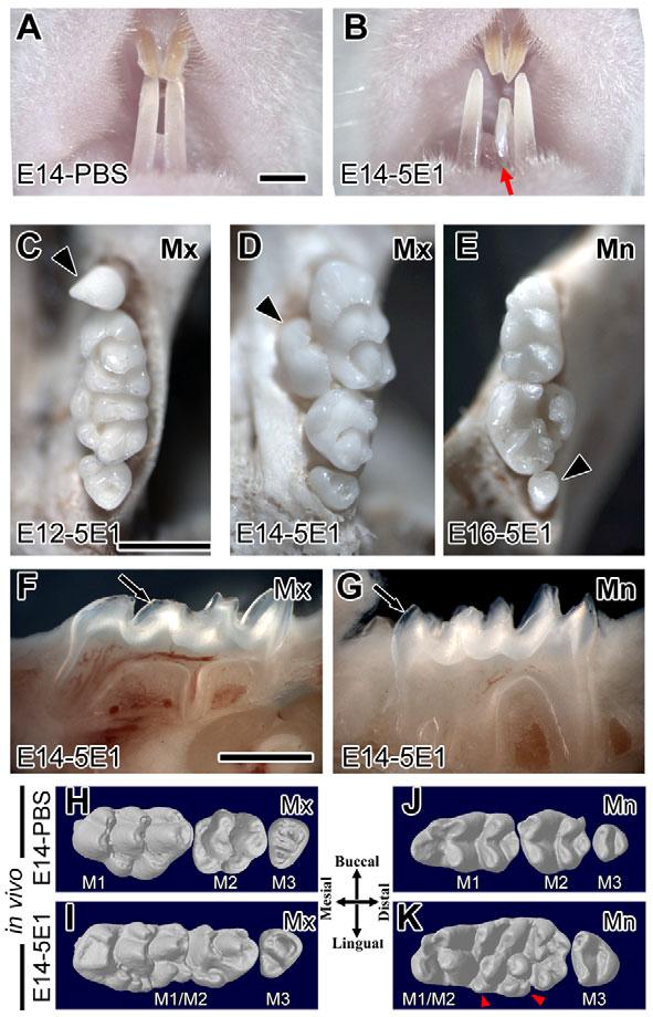 1810 RESEARCH ARTICLE Development 138 (9) In order to investigate how these tooth fusions arise following 5E1 treatment, sections were taken through the developing teeth of embryos at two days after