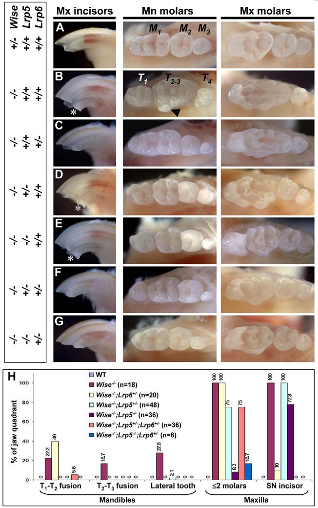 Control of Wnt signaling in tooth development RESEARCH ARTICLE 3223 Fig. 1. Dosage-dependent rescue of Wise tooth phenotypes in Lrp5 and Lrp6 mutants.