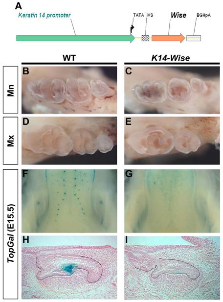 Mandibular molars (top) and corresponding coronal sections (bottom). Fig. 4. Overexpression of Wise disrupted tooth development. (A) K14-Wise transgene.