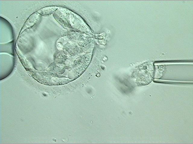 Reduced impact of embryo biopsy Blastocyst cryopreservation (vitrification) necessary Can