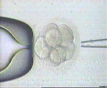 undergoing routine IVF Increase embryo