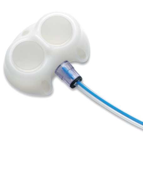 X-Port duo Dual-Lumen Implanted Port Preserves precious vascular access. Ideal for delivering supportive therapies in conjuction with IV chemotherapy.