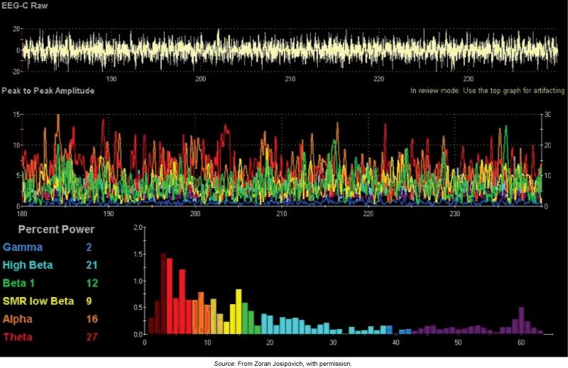 A range of useful tools -measuring electric and magnetic signals Electroencephalography (EEG) recordings reveal brain