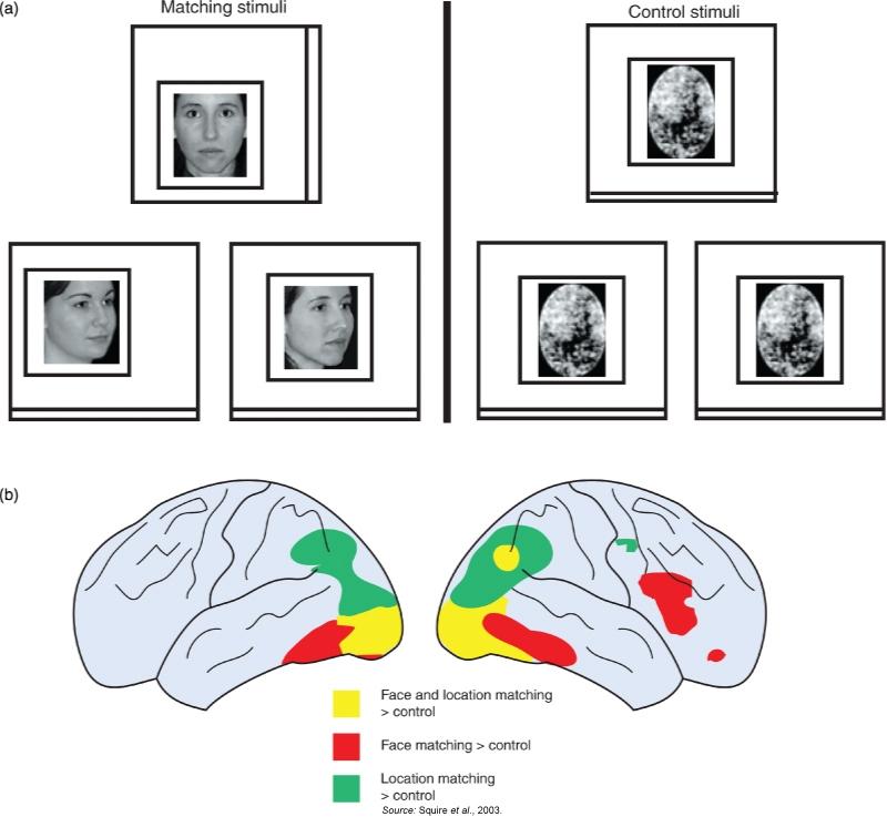 fmri and PET: indirect signals for neural activity Regions of interest: The brain is a dynamic, complex entity.