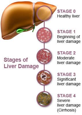 Liver Disease Suggest against warfarin in patients with multiple comorbidities & unable to closely monitor INR Suggest