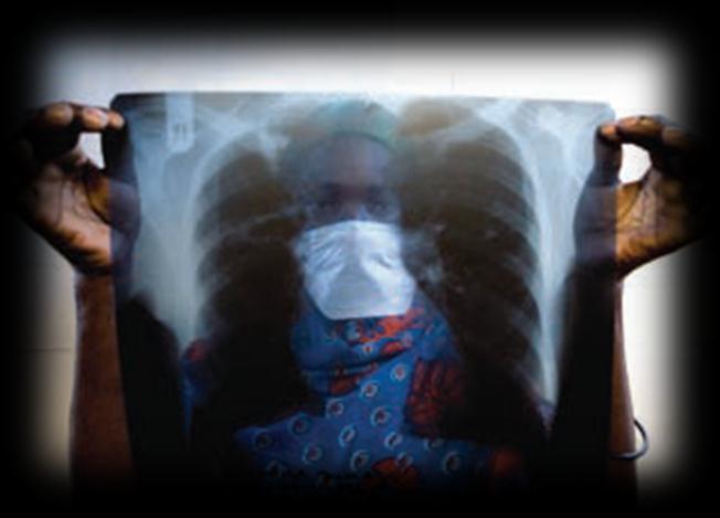 10 mln people develop TB and 2 mln die Drug-resistant TB poised