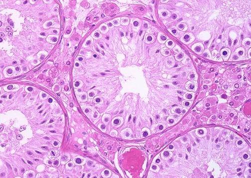 Seminal vesicle Epididymis Prostate Maturation