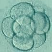 Clinical care of male infertility Male infertility: Obstructive Azoospermia = secretion cause Non Obstructive