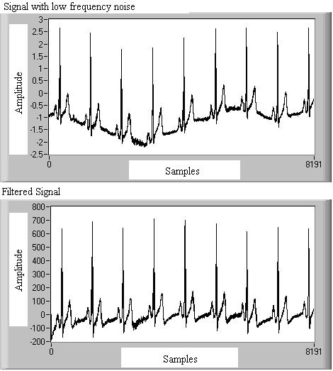 represented in Fig.5: Fig.4.LabVIEW program based on IIR filter, high frequency noise signal upper graph and filtered signal lower graph (x-samples, y-amplitude).