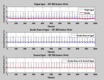 Vol. 1, No.6, December 010 ECG signal Preprocessing QRS Detection P wave Detection T wave Detection Identification Figure 5. Structure of ECG Signal Processing.