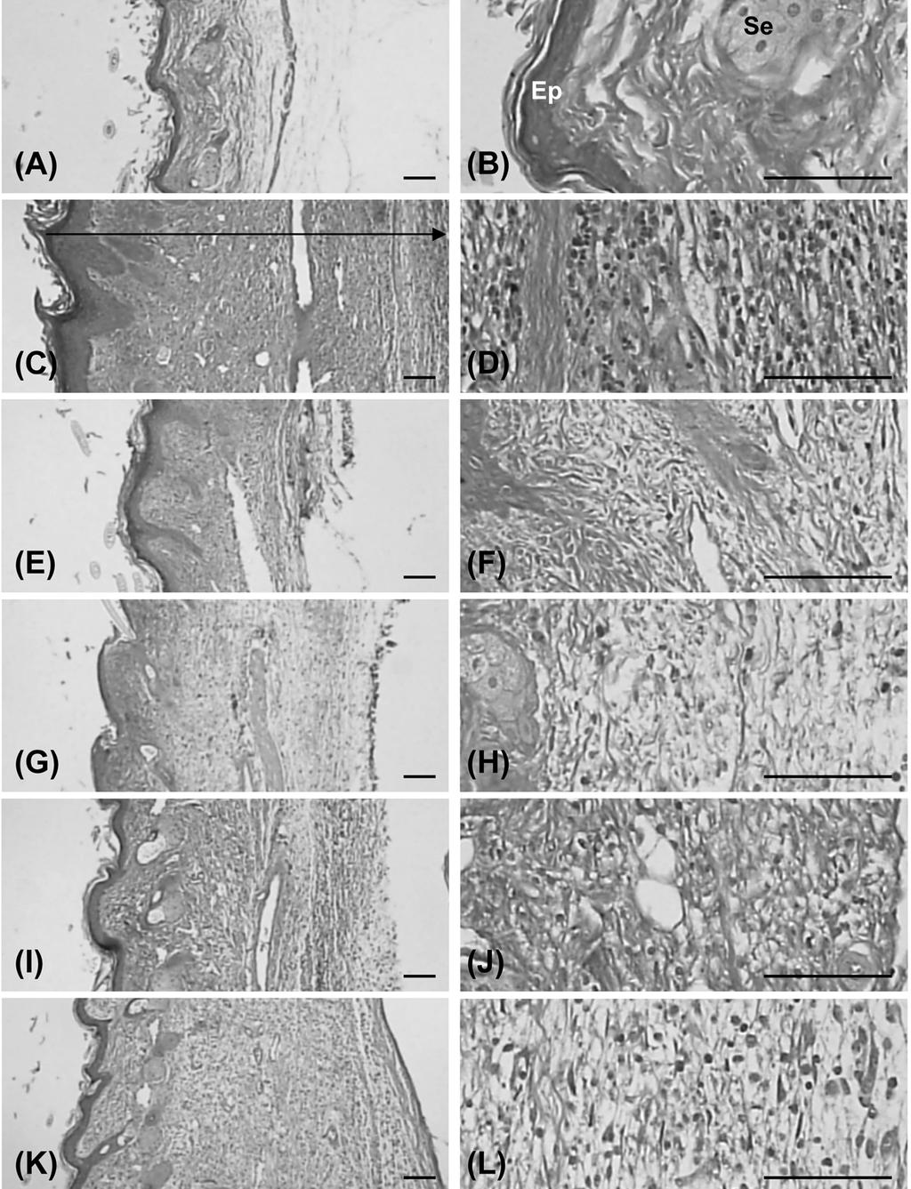 DHU001 Ameliorated Chronic Inflammation Changes on the paw thicknesses. A significant (p < 0.