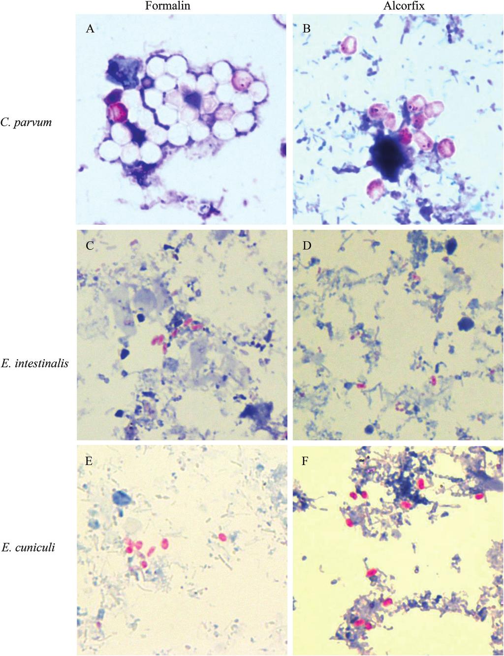 Improved Specimen Processing for Ova and Parasites FIG 3 Representative images of stool specimens spiked with live coccidia (Cryptosporidium parvum) (A and B) or microsporidia (Encephalitozoon