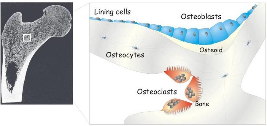 Osteoporosis treatments 2 types Antiresorptives reduce