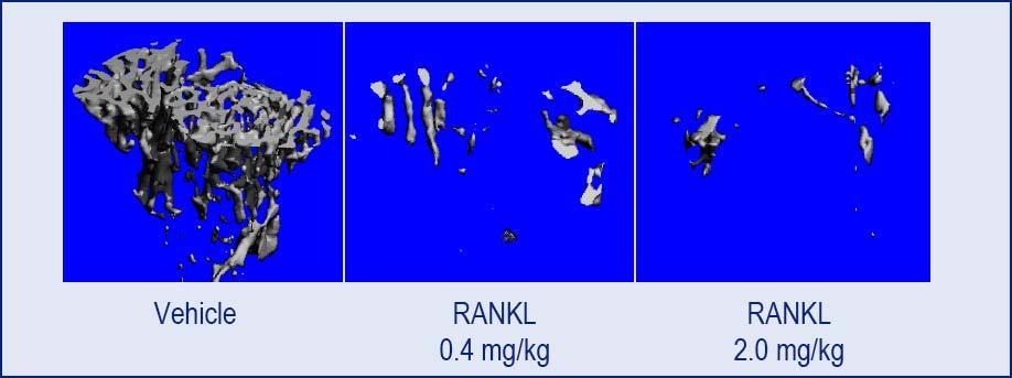 Effects of RANKL on Trabecular Bone in