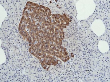 islets with high vriility
