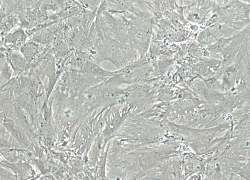 Adipo ADIPOQ mrna ( Ct x 1) c 1..8.6.4.2. hsa (mg/ml).6 -.6 - hfet (mg/ml) -.6 -.6 Plm (µmol/l) - - 6 6 ESM Figure. Cultured humn pncretic dipocytes express diponectin.