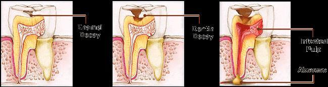Common oral disease 1.