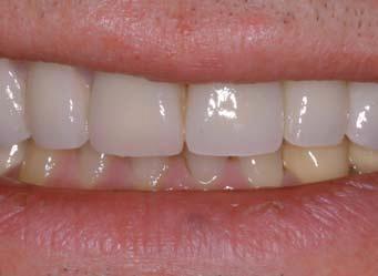 in tooth shape or length n pulpal protection.