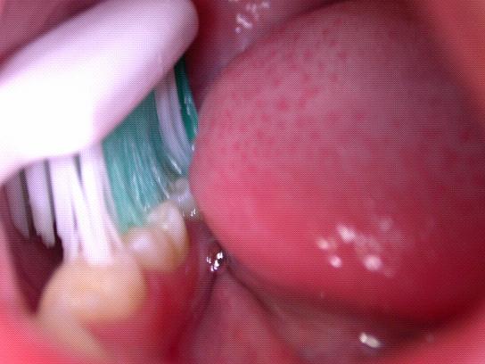 How does gum disease complicate the