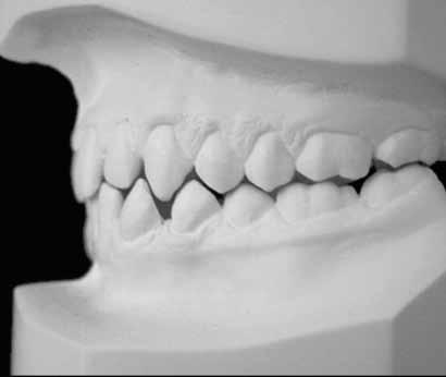 At the bottom of each model a black device was placed with a marking in the center, used as reference to centralize the teeth that would be photographed (Fig 2c), as described in a
