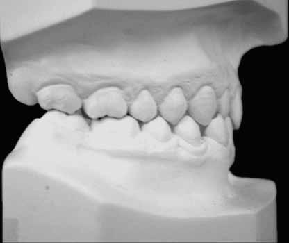 Incisors were positioned in lateral view so as to render visible their inclination (Fig 3B).