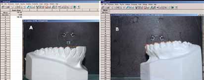 Those images were subsequently imported into an image editing program (Image Tool www.imagetool.com) where canine angulation and incisor inclination were measured.