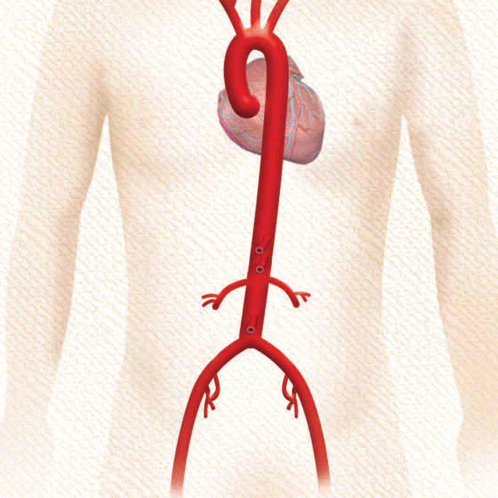 The thoracic aorta has several important arteries which branch of it and provide blood to the heart, brain, head, and