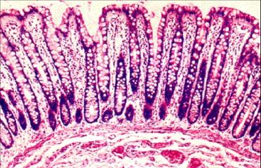 LARGE INTESTINE 12 MAJOR FUNCTIONS: Mostly, absorption of water; no villi. Absorption of bacterial vitamins (K and some B). Storage of feces.