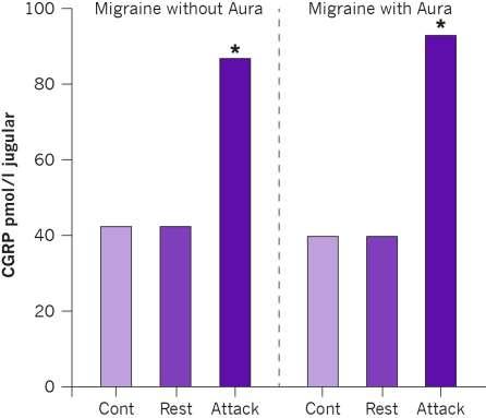 CGRP levels are increased in migraine sufferers During migraine attacks (with or without aura) CGRP levels increase in the extracerebral circulation (external