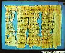 History of Migraine 3000 BC, Sumeria the sick headache The