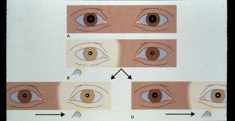 The Eye Examination