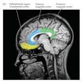 The orbitofrontal cortex is the region of the prefrontal cortex that lies immediately above the orbits that house the