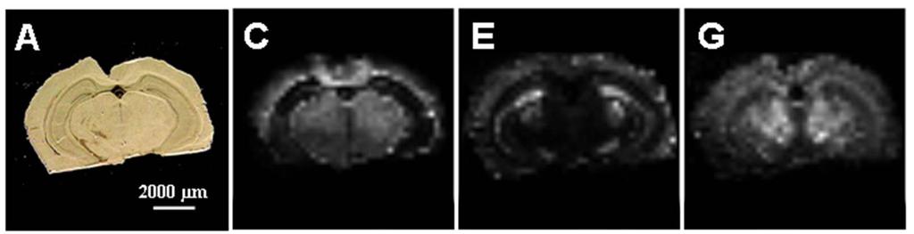 43 Figure 12: Matrix spotting and MALDI imaging of an adult mouse brain tissue section.