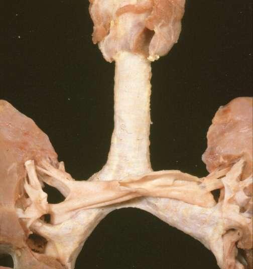 Tracheal Anatomy Inferior thyroid arteries