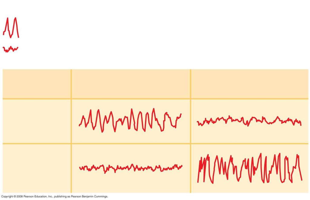 Fig. 49-11 Key Low-frequency waves characteristic of sleep High-frequency waves