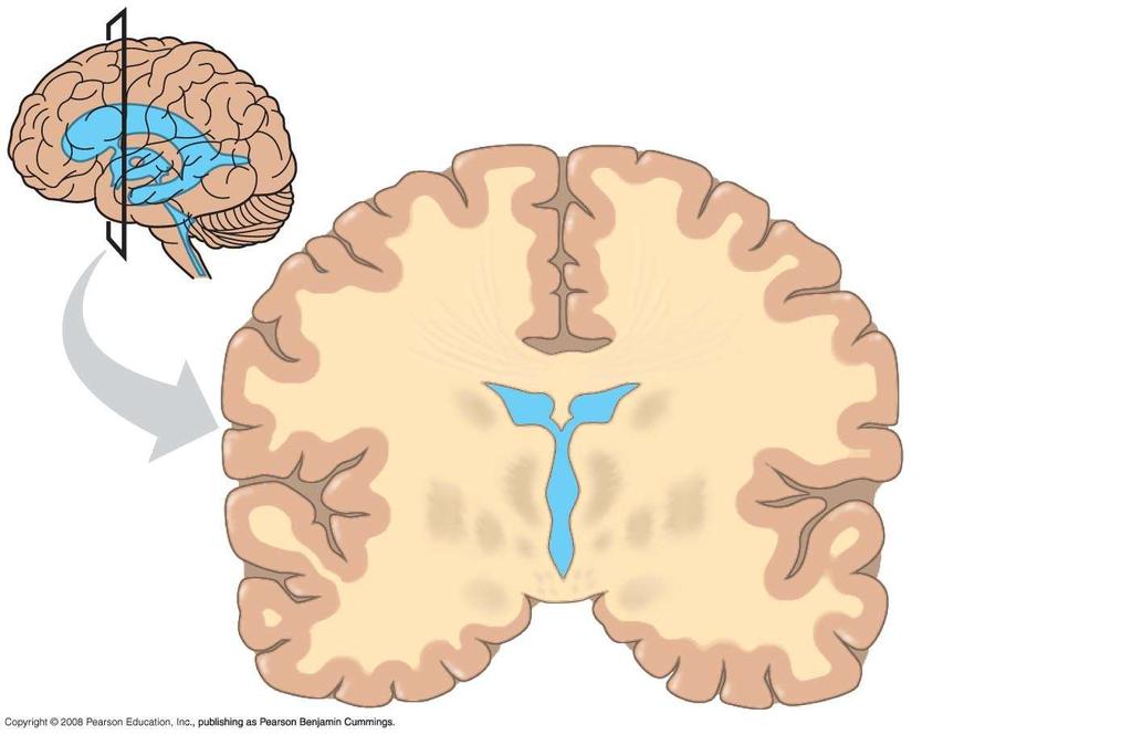 Fig. 49-5 Ventricles, gray matter, and