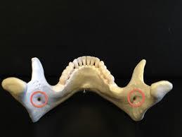 Mandibular foramen Proximal/medial opening for the