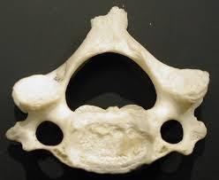 Cervical region Anatomical Features oval concave body large vertebral foramen Stumpy spinous process with