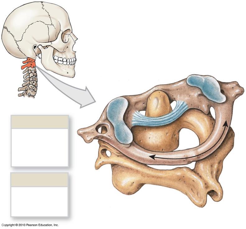 The Atlas and Axis Dens (odontoid process) Ligament Articulates