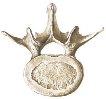 vertebra, lateral view 5 Sacrum (mid-line region
