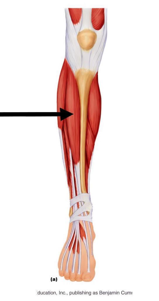 Tibialis anterior Located front of leg Origin: lateral tibia Insertion:
