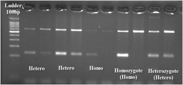 THE RELATIONSHIP BETWEEN THE MUTATION 165 Fig. 3. The primary screening in the patient samples. Fig. 4. Confirming the heterozygote sample by sequencing.