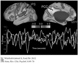 oscillations in different brain regions is interpreted as functional connectivity between those