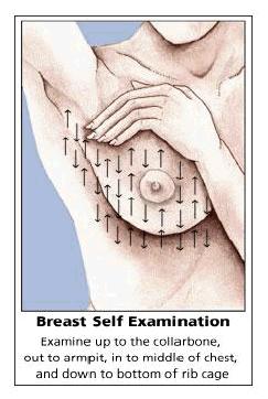3. Breast Self-Awareness Women need to know how their breasts normally look and feel and report
